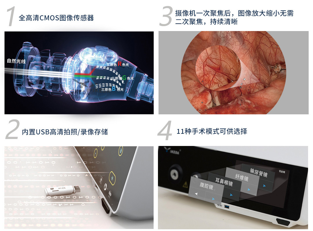 YKD-9100一体化内窥镜影像系统