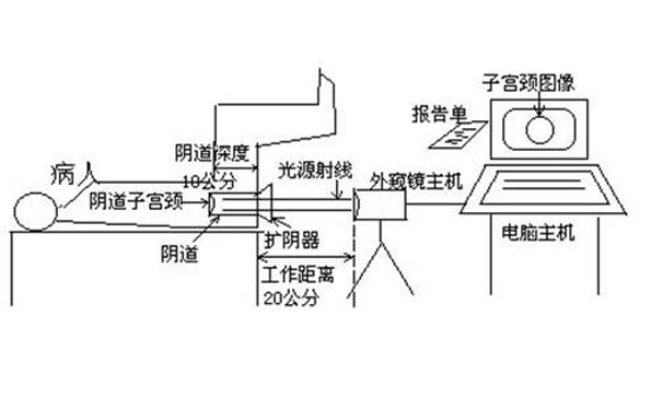 如何使用数码电子阴道镜?